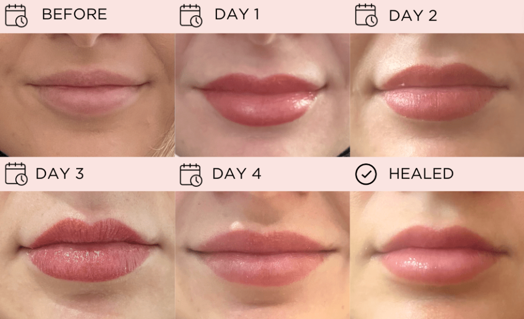 Lip Blush Treatment-Process